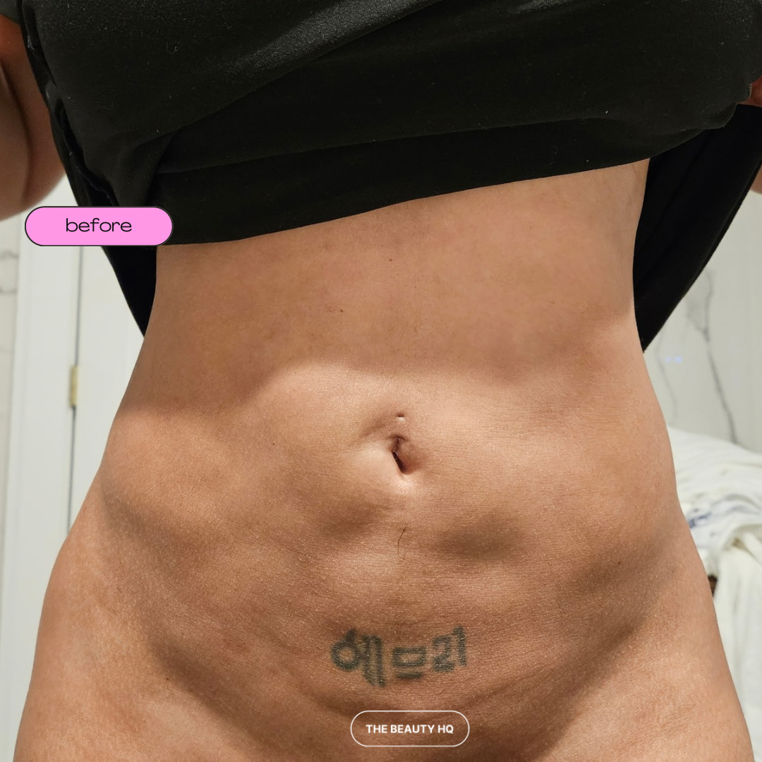 Mobile Post-op Massages *DEPOSITS ONLY*