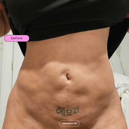 Mobile Post-op Massages *DEPOSITS ONLY*