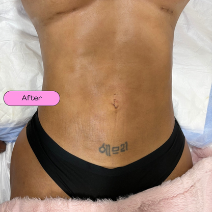 Mobile Post-op Massages *DEPOSITS ONLY*